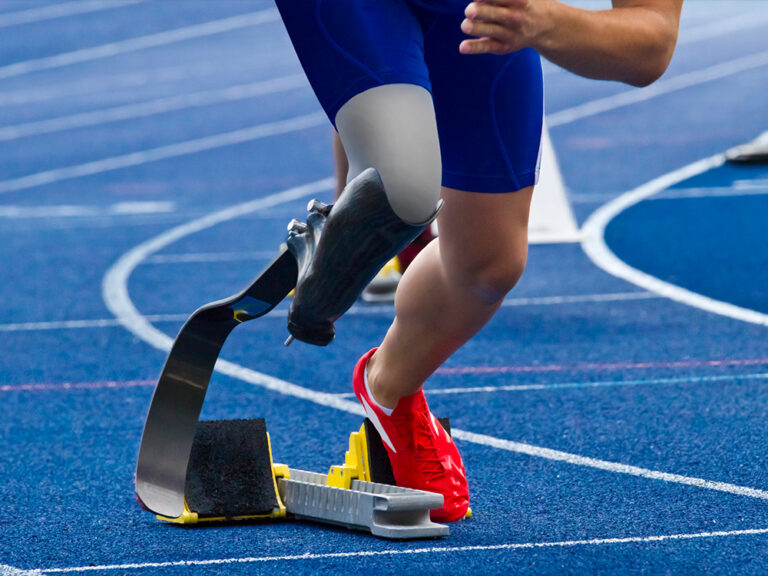 Thumbnail for Can disabled athletes outcompete able-bodied athletes?